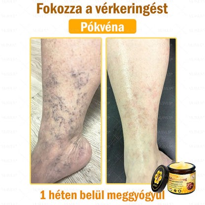 🔥🔥 𝑴é𝒉𝒎é𝒓𝒆𝒈 𝑩ő𝒓 𝑯𝒆𝒍𝒚𝒓𝒆á𝒍𝒍í𝒕ó 𝑲𝒓é𝒎 (👨‍⚕‍𝑪𝑬 𝑻𝒂𝒏ú𝒔í𝒕𝒗á𝒏𝒚) ✅ 𝐀 𝐛ö𝐫𝐩𝐫𝐨𝐛𝐥é𝐦á𝐤 𝐤𝐞𝐳𝐞𝐥é𝐬𝐞 𝐦𝐚𝐠á𝐛𝐚𝐧 𝐟𝐨𝐠𝐥𝐚𝐥𝐣𝐚: é𝐥𝐞𝐭𝐤𝐨𝐫𝐢 𝐟𝐨𝐥𝐭𝐨𝐤, 𝐡𝐞𝐠𝐞𝐤, 𝐬𝐳𝐞𝐦ö𝐥𝐜𝐬ö𝐤, 𝐛ö𝐫𝐧ö𝐯𝐞𝐝é𝐤𝐞𝐤, 𝐭á𝐥𝐲𝐨𝐠𝐨𝐤, 𝐩𝐚𝐭𝐭𝐚𝐧á𝐬𝐨𝐤, 𝐞𝐤𝐜é𝐦𝐚, 𝐩𝐬𝐨𝐫𝐢𝐚𝐬𝐢𝐬, 𝐚𝐜𝐧𝐞 𝐢𝐧𝐯𝐞𝐫𝐬𝐚, 𝐫á𝐧𝐜𝐨𝐤, 𝐛ö𝐫ö𝐫𝐞𝐠𝐞𝐝é𝐬 é𝐬 𝐞𝐠𝐲é𝐛 𝐩𝐫𝐨𝐛𝐥é𝐦á𝐤