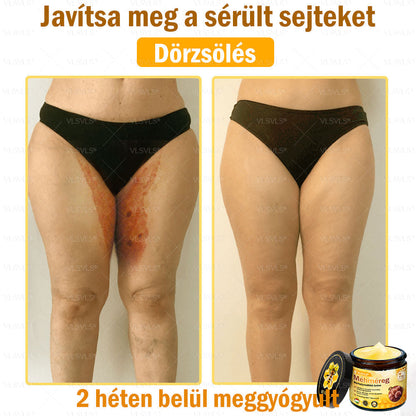 🔥🔥 𝑴é𝒉𝒎é𝒓𝒆𝒈 𝑩ő𝒓 𝑯𝒆𝒍𝒚𝒓𝒆á𝒍𝒍í𝒕ó 𝑲𝒓é𝒎 (👨‍⚕‍𝑪𝑬 𝑻𝒂𝒏ú𝒔í𝒕𝒗á𝒏𝒚) ✅ 𝐀 𝐛ö𝐫𝐩𝐫𝐨𝐛𝐥é𝐦á𝐤 𝐤𝐞𝐳𝐞𝐥é𝐬𝐞 𝐦𝐚𝐠á𝐛𝐚𝐧 𝐟𝐨𝐠𝐥𝐚𝐥𝐣𝐚: é𝐥𝐞𝐭𝐤𝐨𝐫𝐢 𝐟𝐨𝐥𝐭𝐨𝐤, 𝐡𝐞𝐠𝐞𝐤, 𝐬𝐳𝐞𝐦ö𝐥𝐜𝐬ö𝐤, 𝐛ö𝐫𝐧ö𝐯𝐞𝐝é𝐤𝐞𝐤, 𝐭á𝐥𝐲𝐨𝐠𝐨𝐤, 𝐩𝐚𝐭𝐭𝐚𝐧á𝐬𝐨𝐤, 𝐞𝐤𝐜é𝐦𝐚, 𝐩𝐬𝐨𝐫𝐢𝐚𝐬𝐢𝐬, 𝐚𝐜𝐧𝐞 𝐢𝐧𝐯𝐞𝐫𝐬𝐚, 𝐫á𝐧𝐜𝐨𝐤, 𝐛ö𝐫ö𝐫𝐞𝐠𝐞𝐝é𝐬 é𝐬 𝐞𝐠𝐲é𝐛 𝐩𝐫𝐨𝐛𝐥é𝐦á𝐤