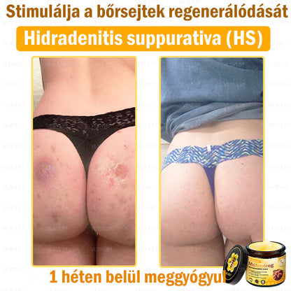 🔥🔥 𝑴é𝒉𝒎é𝒓𝒆𝒈 𝑩ő𝒓 𝑯𝒆𝒍𝒚𝒓𝒆á𝒍𝒍í𝒕ó 𝑲𝒓é𝒎 (👨‍⚕‍𝑪𝑬 𝑻𝒂𝒏ú𝒔í𝒕𝒗á𝒏𝒚) ✅ 𝐀 𝐛ö𝐫𝐩𝐫𝐨𝐛𝐥é𝐦á𝐤 𝐤𝐞𝐳𝐞𝐥é𝐬𝐞 𝐦𝐚𝐠á𝐛𝐚𝐧 𝐟𝐨𝐠𝐥𝐚𝐥𝐣𝐚: é𝐥𝐞𝐭𝐤𝐨𝐫𝐢 𝐟𝐨𝐥𝐭𝐨𝐤, 𝐡𝐞𝐠𝐞𝐤, 𝐬𝐳𝐞𝐦ö𝐥𝐜𝐬ö𝐤, 𝐛ö𝐫𝐧ö𝐯𝐞𝐝é𝐤𝐞𝐤, 𝐭á𝐥𝐲𝐨𝐠𝐨𝐤, 𝐩𝐚𝐭𝐭𝐚𝐧á𝐬𝐨𝐤, 𝐞𝐤𝐜é𝐦𝐚, 𝐩𝐬𝐨𝐫𝐢𝐚𝐬𝐢𝐬, 𝐚𝐜𝐧𝐞 𝐢𝐧𝐯𝐞𝐫𝐬𝐚, 𝐫á𝐧𝐜𝐨𝐤, 𝐛ö𝐫ö𝐫𝐞𝐠𝐞𝐝é𝐬 é𝐬 𝐞𝐠𝐲é𝐛 𝐩𝐫𝐨𝐛𝐥é𝐦á𝐤