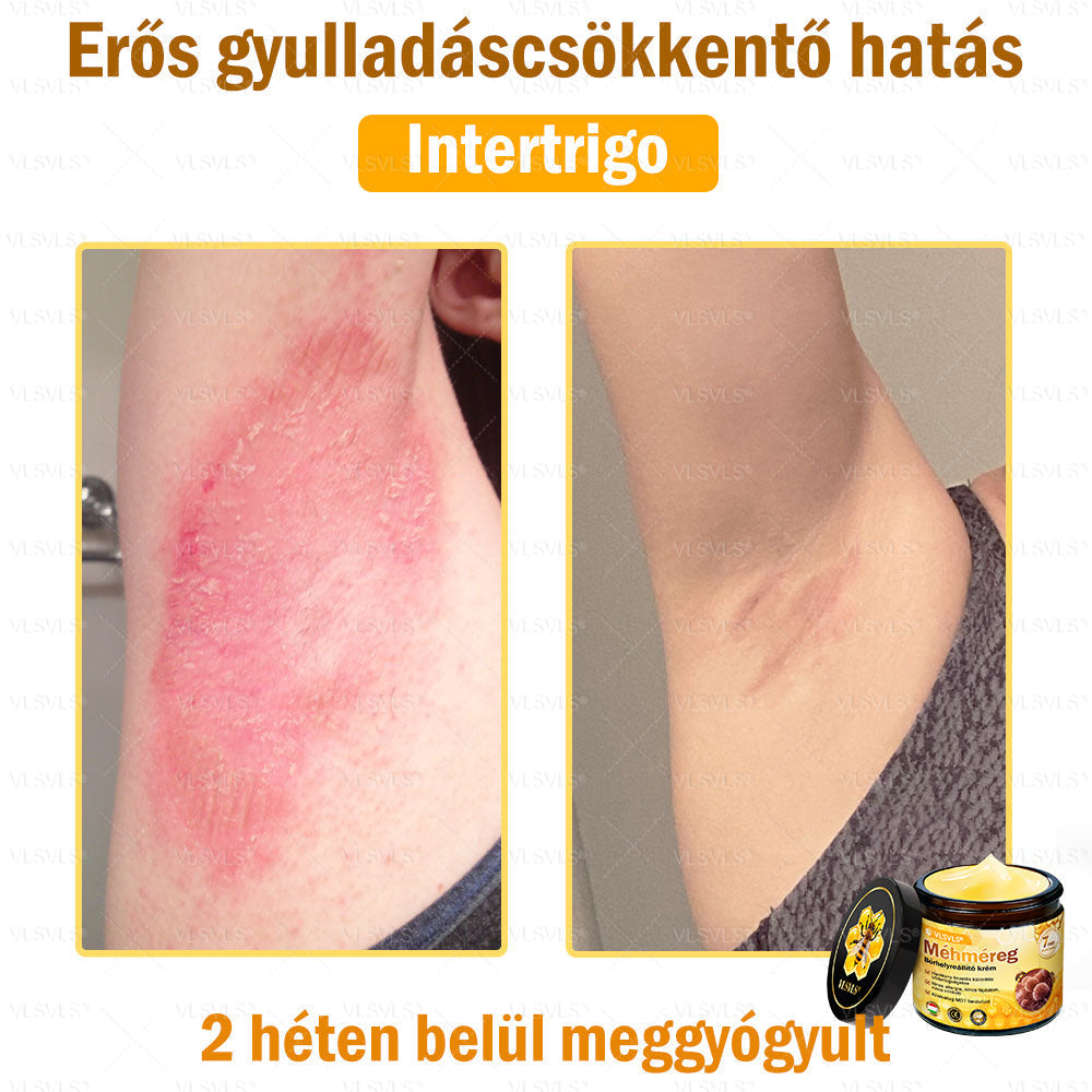 🔥🔥 𝑴é𝒉𝒎é𝒓𝒆𝒈 𝑩ő𝒓 𝑯𝒆𝒍𝒚𝒓𝒆á𝒍𝒍í𝒕ó 𝑲𝒓é𝒎 (👨‍⚕‍𝑪𝑬 𝑻𝒂𝒏ú𝒔í𝒕𝒗á𝒏𝒚) ✅ 𝐀 𝐛ö𝐫𝐩𝐫𝐨𝐛𝐥é𝐦á𝐤 𝐤𝐞𝐳𝐞𝐥é𝐬𝐞 𝐦𝐚𝐠á𝐛𝐚𝐧 𝐟𝐨𝐠𝐥𝐚𝐥𝐣𝐚: é𝐥𝐞𝐭𝐤𝐨𝐫𝐢 𝐟𝐨𝐥𝐭𝐨𝐤, 𝐡𝐞𝐠𝐞𝐤, 𝐬𝐳𝐞𝐦ö𝐥𝐜𝐬ö𝐤, 𝐛ö𝐫𝐧ö𝐯𝐞𝐝é𝐤𝐞𝐤, 𝐭á𝐥𝐲𝐨𝐠𝐨𝐤, 𝐩𝐚𝐭𝐭𝐚𝐧á𝐬𝐨𝐤, 𝐞𝐤𝐜é𝐦𝐚, 𝐩𝐬𝐨𝐫𝐢𝐚𝐬𝐢𝐬, 𝐚𝐜𝐧𝐞 𝐢𝐧𝐯𝐞𝐫𝐬𝐚, 𝐫á𝐧𝐜𝐨𝐤, 𝐛ö𝐫ö𝐫𝐞𝐠𝐞𝐝é𝐬 é𝐬 𝐞𝐠𝐲é𝐛 𝐩𝐫𝐨𝐛𝐥é𝐦á𝐤