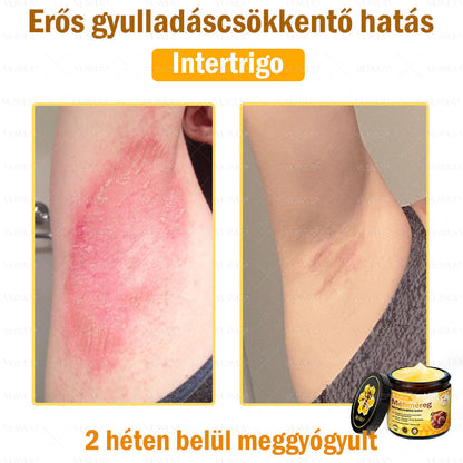 🔥🔥 𝑴é𝒉𝒎é𝒓𝒆𝒈 𝑩ő𝒓 𝑯𝒆𝒍𝒚𝒓𝒆á𝒍𝒍í𝒕ó 𝑲𝒓é𝒎 (👨‍⚕‍𝑪𝑬 𝑻𝒂𝒏ú𝒔í𝒕𝒗á𝒏𝒚) ✅ 𝐀 𝐛ö𝐫𝐩𝐫𝐨𝐛𝐥é𝐦á𝐤 𝐤𝐞𝐳𝐞𝐥é𝐬𝐞 𝐦𝐚𝐠á𝐛𝐚𝐧 𝐟𝐨𝐠𝐥𝐚𝐥𝐣𝐚: é𝐥𝐞𝐭𝐤𝐨𝐫𝐢 𝐟𝐨𝐥𝐭𝐨𝐤, 𝐡𝐞𝐠𝐞𝐤, 𝐬𝐳𝐞𝐦ö𝐥𝐜𝐬ö𝐤, 𝐛ö𝐫𝐧ö𝐯𝐞𝐝é𝐤𝐞𝐤, 𝐭á𝐥𝐲𝐨𝐠𝐨𝐤, 𝐩𝐚𝐭𝐭𝐚𝐧á𝐬𝐨𝐤, 𝐞𝐤𝐜é𝐦𝐚, 𝐩𝐬𝐨𝐫𝐢𝐚𝐬𝐢𝐬, 𝐚𝐜𝐧𝐞 𝐢𝐧𝐯𝐞𝐫𝐬𝐚, 𝐫á𝐧𝐜𝐨𝐤, 𝐛ö𝐫ö𝐫𝐞𝐠𝐞𝐝é𝐬 é𝐬 𝐞𝐠𝐲é𝐛 𝐩𝐫𝐨𝐛𝐥é𝐦á𝐤