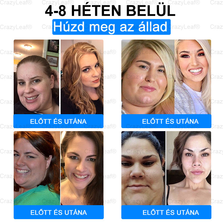 Csak 5 doboz maradt! – HOUKEA® GLP-1 Tapasz 40% kedvezménnyel | Zsírégetés, Vércukor-egyensúly, Bőrfeszesítés 7 nap alatt! Ne hagyd ki a lehetőséget - ez az ajánlat csak jövőre jön újra. Cselekedjen gyorsan! 180 napos pénzvisszafizetési garancia!！