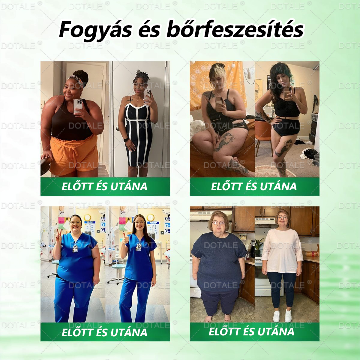 👨‍⚕️🩺Hivatalos Bolt - 𝑫𝑶𝖳𝖠𝐋𝐄® 𝑴𝒆𝐭𝐚𝐛𝐨𝐥𝐢𝐤𝐮𝐬 𝑵𝒂𝐧𝐨 𝑴𝒊𝒌𝒓𝐨𝐭ú𝐬 𝑇𝑎𝒑𝐚𝐬𝐳(Napi egyszeri használat, eredmények 7 napon belül!) ✅ Berenil + Moringa formuláció, ideális tömegtúlzsúlláshoz, bőrhiányossághoz, cukorbetegséghez, apnához és ízületi problémákhoz