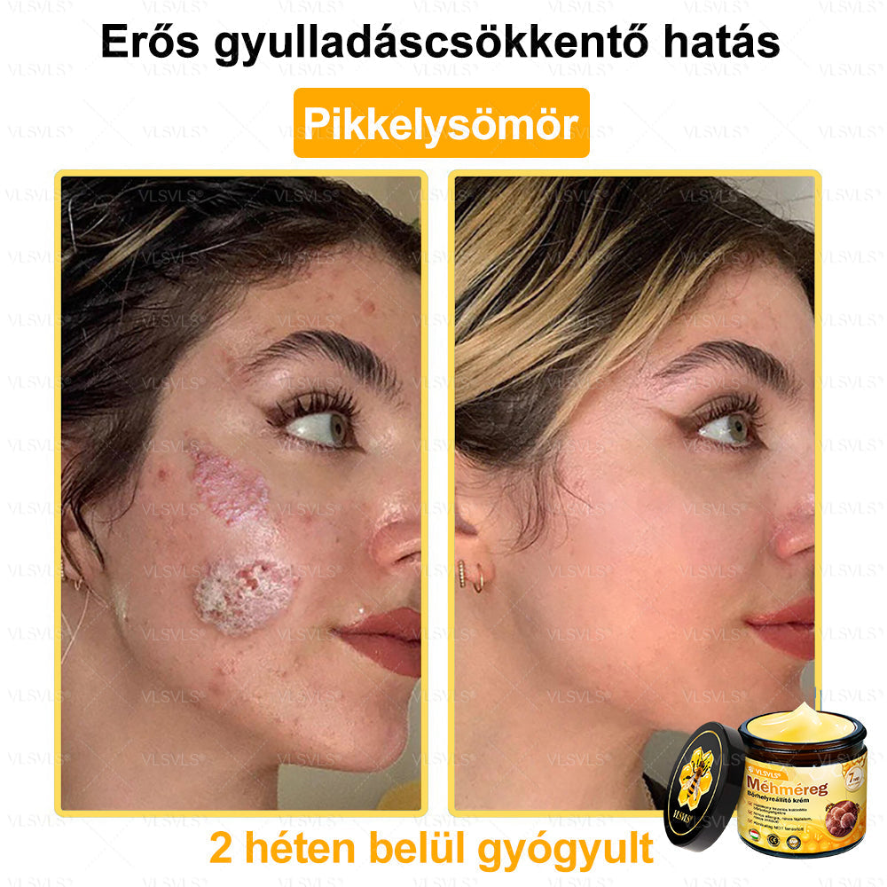 🔥🔥 𝑴é𝒉𝒎é𝒓𝒆𝒈 𝑩ő𝒓 𝑯𝒆𝒍𝒚𝒓𝒆á𝒍𝒍í𝒕ó 𝑲𝒓é𝒎 (👨‍⚕‍𝑪𝑬 𝑻𝒂𝒏ú𝒔í𝒕𝒗á𝒏𝒚) ✅ 𝐀 𝐛ö𝐫𝐩𝐫𝐨𝐛𝐥é𝐦á𝐤 𝐤𝐞𝐳𝐞𝐥é𝐬𝐞 𝐦𝐚𝐠á𝐛𝐚𝐧 𝐟𝐨𝐠𝐥𝐚𝐥𝐣𝐚: é𝐥𝐞𝐭𝐤𝐨𝐫𝐢 𝐟𝐨𝐥𝐭𝐨𝐤, 𝐡𝐞𝐠𝐞𝐤, 𝐬𝐳𝐞𝐦ö𝐥𝐜𝐬ö𝐤, 𝐛ö𝐫𝐧ö𝐯𝐞𝐝é𝐤𝐞𝐤, 𝐭á𝐥𝐲𝐨𝐠𝐨𝐤, 𝐩𝐚𝐭𝐭𝐚𝐧á𝐬𝐨𝐤, 𝐞𝐤𝐜é𝐦𝐚, 𝐩𝐬𝐨𝐫𝐢𝐚𝐬𝐢𝐬, 𝐚𝐜𝐧𝐞 𝐢𝐧𝐯𝐞𝐫𝐬𝐚, 𝐫á𝐧𝐜𝐨𝐤, 𝐛ö𝐫ö𝐫𝐞𝐠𝐞𝐝é𝐬 é𝐬 𝐞𝐠𝐲é𝐛 𝐩𝐫𝐨𝐛𝐥é𝐦á𝐤