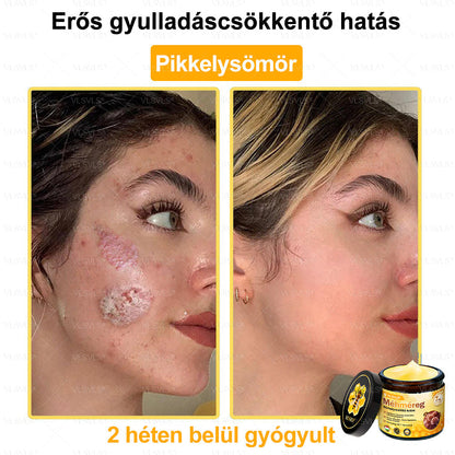 🔥🔥 𝑴é𝒉𝒎é𝒓𝒆𝒈 𝑩ő𝒓 𝑯𝒆𝒍𝒚𝒓𝒆á𝒍𝒍í𝒕ó 𝑲𝒓é𝒎 (👨‍⚕‍𝑪𝑬 𝑻𝒂𝒏ú𝒔í𝒕𝒗á𝒏𝒚) ✅ 𝐀 𝐛ö𝐫𝐩𝐫𝐨𝐛𝐥é𝐦á𝐤 𝐤𝐞𝐳𝐞𝐥é𝐬𝐞 𝐦𝐚𝐠á𝐛𝐚𝐧 𝐟𝐨𝐠𝐥𝐚𝐥𝐣𝐚: é𝐥𝐞𝐭𝐤𝐨𝐫𝐢 𝐟𝐨𝐥𝐭𝐨𝐤, 𝐡𝐞𝐠𝐞𝐤, 𝐬𝐳𝐞𝐦ö𝐥𝐜𝐬ö𝐤, 𝐛ö𝐫𝐧ö𝐯𝐞𝐝é𝐤𝐞𝐤, 𝐭á𝐥𝐲𝐨𝐠𝐨𝐤, 𝐩𝐚𝐭𝐭𝐚𝐧á𝐬𝐨𝐤, 𝐞𝐤𝐜é𝐦𝐚, 𝐩𝐬𝐨𝐫𝐢𝐚𝐬𝐢𝐬, 𝐚𝐜𝐧𝐞 𝐢𝐧𝐯𝐞𝐫𝐬𝐚, 𝐫á𝐧𝐜𝐨𝐤, 𝐛ö𝐫ö𝐫𝐞𝐠𝐞𝐝é𝐬 é𝐬 𝐞𝐠𝐲é𝐛 𝐩𝐫𝐨𝐛𝐥é𝐦á𝐤