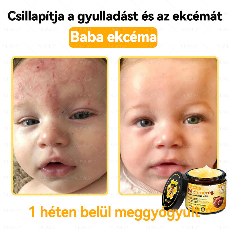 🔥🔥 𝑴é𝒉𝒎é𝒓𝒆𝒈 𝑩ő𝒓 𝑯𝒆𝒍𝒚𝒓𝒆á𝒍𝒍í𝒕ó 𝑲𝒓é𝒎 (👨‍⚕‍𝑪𝑬 𝑻𝒂𝒏ú𝒔í𝒕𝒗á𝒏𝒚) ✅ 𝐀 𝐛ö𝐫𝐩𝐫𝐨𝐛𝐥é𝐦á𝐤 𝐤𝐞𝐳𝐞𝐥é𝐬𝐞 𝐦𝐚𝐠á𝐛𝐚𝐧 𝐟𝐨𝐠𝐥𝐚𝐥𝐣𝐚: é𝐥𝐞𝐭𝐤𝐨𝐫𝐢 𝐟𝐨𝐥𝐭𝐨𝐤, 𝐡𝐞𝐠𝐞𝐤, 𝐬𝐳𝐞𝐦ö𝐥𝐜𝐬ö𝐤, 𝐛ö𝐫𝐧ö𝐯𝐞𝐝é𝐤𝐞𝐤, 𝐭á𝐥𝐲𝐨𝐠𝐨𝐤, 𝐩𝐚𝐭𝐭𝐚𝐧á𝐬𝐨𝐤, 𝐞𝐤𝐜é𝐦𝐚, 𝐩𝐬𝐨𝐫𝐢𝐚𝐬𝐢𝐬, 𝐚𝐜𝐧𝐞 𝐢𝐧𝐯𝐞𝐫𝐬𝐚, 𝐫á𝐧𝐜𝐨𝐤, 𝐛ö𝐫ö𝐫𝐞𝐠𝐞𝐝é𝐬 é𝐬 𝐞𝐠𝐲é𝐛 𝐩𝐫𝐨𝐛𝐥é𝐦á𝐤