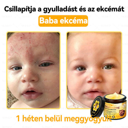 🔥🔥 𝑴é𝒉𝒎é𝒓𝒆𝒈 𝑩ő𝒓 𝑯𝒆𝒍𝒚𝒓𝒆á𝒍𝒍í𝒕ó 𝑲𝒓é𝒎 (👨‍⚕‍𝑪𝑬 𝑻𝒂𝒏ú𝒔í𝒕𝒗á𝒏𝒚) ✅ 𝐀 𝐛ö𝐫𝐩𝐫𝐨𝐛𝐥é𝐦á𝐤 𝐤𝐞𝐳𝐞𝐥é𝐬𝐞 𝐦𝐚𝐠á𝐛𝐚𝐧 𝐟𝐨𝐠𝐥𝐚𝐥𝐣𝐚: é𝐥𝐞𝐭𝐤𝐨𝐫𝐢 𝐟𝐨𝐥𝐭𝐨𝐤, 𝐡𝐞𝐠𝐞𝐤, 𝐬𝐳𝐞𝐦ö𝐥𝐜𝐬ö𝐤, 𝐛ö𝐫𝐧ö𝐯𝐞𝐝é𝐤𝐞𝐤, 𝐭á𝐥𝐲𝐨𝐠𝐨𝐤, 𝐩𝐚𝐭𝐭𝐚𝐧á𝐬𝐨𝐤, 𝐞𝐤𝐜é𝐦𝐚, 𝐩𝐬𝐨𝐫𝐢𝐚𝐬𝐢𝐬, 𝐚𝐜𝐧𝐞 𝐢𝐧𝐯𝐞𝐫𝐬𝐚, 𝐫á𝐧𝐜𝐨𝐤, 𝐛ö𝐫ö𝐫𝐞𝐠𝐞𝐝é𝐬 é𝐬 𝐞𝐠𝐲é𝐛 𝐩𝐫𝐨𝐛𝐥é𝐦á𝐤