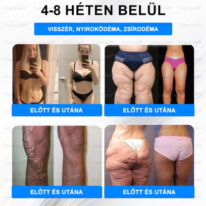 Csak 5 doboz maradt! – HOUKEA® GLP-1 Tapasz 40% kedvezménnyel | Zsírégetés, Vércukor-egyensúly, Bőrfeszesítés 7 nap alatt! Ne hagyd ki a lehetőséget - ez az ajánlat csak jövőre jön újra. Cselekedjen gyorsan! 180 napos pénzvisszafizetési garancia!！