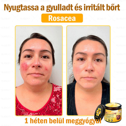 🔥🔥 𝑴é𝒉𝒎é𝒓𝒆𝒈 𝑩ő𝒓 𝑯𝒆𝒍𝒚𝒓𝒆á𝒍𝒍í𝒕ó 𝑲𝒓é𝒎 (👨‍⚕‍𝑪𝑬 𝑻𝒂𝒏ú𝒔í𝒕𝒗á𝒏𝒚) ✅ 𝐀 𝐛ö𝐫𝐩𝐫𝐨𝐛𝐥é𝐦á𝐤 𝐤𝐞𝐳𝐞𝐥é𝐬𝐞 𝐦𝐚𝐠á𝐛𝐚𝐧 𝐟𝐨𝐠𝐥𝐚𝐥𝐣𝐚: é𝐥𝐞𝐭𝐤𝐨𝐫𝐢 𝐟𝐨𝐥𝐭𝐨𝐤, 𝐡𝐞𝐠𝐞𝐤, 𝐬𝐳𝐞𝐦ö𝐥𝐜𝐬ö𝐤, 𝐛ö𝐫𝐧ö𝐯𝐞𝐝é𝐤𝐞𝐤, 𝐭á𝐥𝐲𝐨𝐠𝐨𝐤, 𝐩𝐚𝐭𝐭𝐚𝐧á𝐬𝐨𝐤, 𝐞𝐤𝐜é𝐦𝐚, 𝐩𝐬𝐨𝐫𝐢𝐚𝐬𝐢𝐬, 𝐚𝐜𝐧𝐞 𝐢𝐧𝐯𝐞𝐫𝐬𝐚, 𝐫á𝐧𝐜𝐨𝐤, 𝐛ö𝐫ö𝐫𝐞𝐠𝐞𝐝é𝐬 é𝐬 𝐞𝐠𝐲é𝐛 𝐩𝐫𝐨𝐛𝐥é𝐦á𝐤