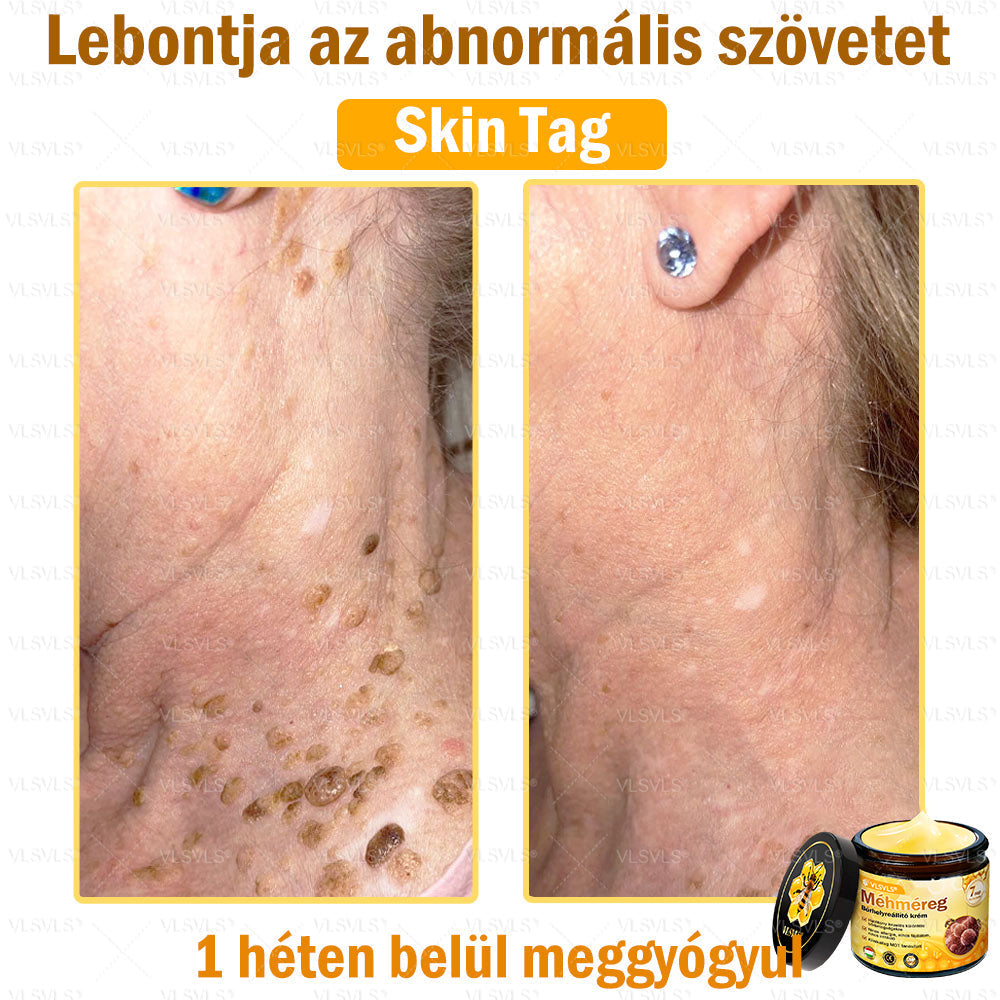 🔥🔥 𝑴é𝒉𝒎é𝒓𝒆𝒈 𝑩ő𝒓 𝑯𝒆𝒍𝒚𝒓𝒆á𝒍𝒍í𝒕ó 𝑲𝒓é𝒎 (👨‍⚕‍𝑪𝑬 𝑻𝒂𝒏ú𝒔í𝒕𝒗á𝒏𝒚) ✅ 𝐀 𝐛ö𝐫𝐩𝐫𝐨𝐛𝐥é𝐦á𝐤 𝐤𝐞𝐳𝐞𝐥é𝐬𝐞 𝐦𝐚𝐠á𝐛𝐚𝐧 𝐟𝐨𝐠𝐥𝐚𝐥𝐣𝐚: é𝐥𝐞𝐭𝐤𝐨𝐫𝐢 𝐟𝐨𝐥𝐭𝐨𝐤, 𝐡𝐞𝐠𝐞𝐤, 𝐬𝐳𝐞𝐦ö𝐥𝐜𝐬ö𝐤, 𝐛ö𝐫𝐧ö𝐯𝐞𝐝é𝐤𝐞𝐤, 𝐭á𝐥𝐲𝐨𝐠𝐨𝐤, 𝐩𝐚𝐭𝐭𝐚𝐧á𝐬𝐨𝐤, 𝐞𝐤𝐜é𝐦𝐚, 𝐩𝐬𝐨𝐫𝐢𝐚𝐬𝐢𝐬, 𝐚𝐜𝐧𝐞 𝐢𝐧𝐯𝐞𝐫𝐬𝐚, 𝐫á𝐧𝐜𝐨𝐤, 𝐛ö𝐫ö𝐫𝐞𝐠𝐞𝐝é𝐬 é𝐬 𝐞𝐠𝐲é𝐛 𝐩𝐫𝐨𝐛𝐥é𝐦á𝐤