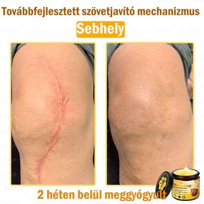 🔥🔥 𝑴é𝒉𝒎é𝒓𝒆𝒈 𝑩ő𝒓 𝑯𝒆𝒍𝒚𝒓𝒆á𝒍𝒍í𝒕ó 𝑲𝒓é𝒎 (👨‍⚕‍𝑪𝑬 𝑻𝒂𝒏ú𝒔í𝒕𝒗á𝒏𝒚) ✅ 𝐀 𝐛ö𝐫𝐩𝐫𝐨𝐛𝐥é𝐦á𝐤 𝐤𝐞𝐳𝐞𝐥é𝐬𝐞 𝐦𝐚𝐠á𝐛𝐚𝐧 𝐟𝐨𝐠𝐥𝐚𝐥𝐣𝐚: é𝐥𝐞𝐭𝐤𝐨𝐫𝐢 𝐟𝐨𝐥𝐭𝐨𝐤, 𝐡𝐞𝐠𝐞𝐤, 𝐬𝐳𝐞𝐦ö𝐥𝐜𝐬ö𝐤, 𝐛ö𝐫𝐧ö𝐯𝐞𝐝é𝐤𝐞𝐤, 𝐭á𝐥𝐲𝐨𝐠𝐨𝐤, 𝐩𝐚𝐭𝐭𝐚𝐧á𝐬𝐨𝐤, 𝐞𝐤𝐜é𝐦𝐚, 𝐩𝐬𝐨𝐫𝐢𝐚𝐬𝐢𝐬, 𝐚𝐜𝐧𝐞 𝐢𝐧𝐯𝐞𝐫𝐬𝐚, 𝐫á𝐧𝐜𝐨𝐤, 𝐛ö𝐫ö𝐫𝐞𝐠𝐞𝐝é𝐬 é𝐬 𝐞𝐠𝐲é𝐛 𝐩𝐫𝐨𝐛𝐥é𝐦á𝐤