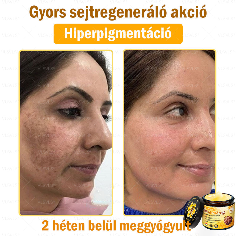 🔥🔥 𝑴é𝒉𝒎é𝒓𝒆𝒈 𝑩ő𝒓 𝑯𝒆𝒍𝒚𝒓𝒆á𝒍𝒍í𝒕ó 𝑲𝒓é𝒎 (👨‍⚕‍𝑪𝑬 𝑻𝒂𝒏ú𝒔í𝒕𝒗á𝒏𝒚) ✅ 𝐀 𝐛ö𝐫𝐩𝐫𝐨𝐛𝐥é𝐦á𝐤 𝐤𝐞𝐳𝐞𝐥é𝐬𝐞 𝐦𝐚𝐠á𝐛𝐚𝐧 𝐟𝐨𝐠𝐥𝐚𝐥𝐣𝐚: é𝐥𝐞𝐭𝐤𝐨𝐫𝐢 𝐟𝐨𝐥𝐭𝐨𝐤, 𝐡𝐞𝐠𝐞𝐤, 𝐬𝐳𝐞𝐦ö𝐥𝐜𝐬ö𝐤, 𝐛ö𝐫𝐧ö𝐯𝐞𝐝é𝐤𝐞𝐤, 𝐭á𝐥𝐲𝐨𝐠𝐨𝐤, 𝐩𝐚𝐭𝐭𝐚𝐧á𝐬𝐨𝐤, 𝐞𝐤𝐜é𝐦𝐚, 𝐩𝐬𝐨𝐫𝐢𝐚𝐬𝐢𝐬, 𝐚𝐜𝐧𝐞 𝐢𝐧𝐯𝐞𝐫𝐬𝐚, 𝐫á𝐧𝐜𝐨𝐤, 𝐛ö𝐫ö𝐫𝐞𝐠𝐞𝐝é𝐬 é𝐬 𝐞𝐠𝐲é𝐛 𝐩𝐫𝐨𝐛𝐥é𝐦á𝐤