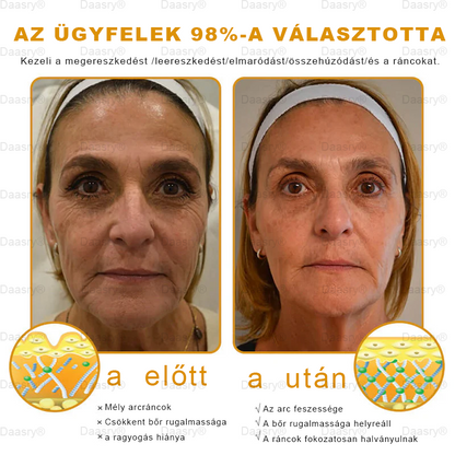 Csak 5 üveg! Éljen az exkluzív 40%-os kedvezménnyel most! Tartsa bőrét fiatalosnak és ragyogónak mindössze 1-4 hét alatt. Ne hagyd ki a lehetőséget - ez az ajánlat csak jövőre jön újra. Cselekedjen gyorsan! 180 napos pénzvisszafizetési garancia!！