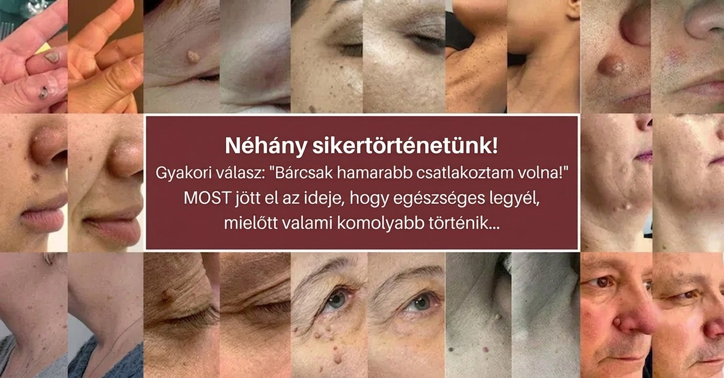 ✨HISKIN® 2 az 1-ben mikrotűs és hidrokolloid tapasz🍀 | Kiemelkedő anyajegyek, pattanások, lapos szemölcsök és bőrcimpák eltávolítására | Segít csökkenteni a ráncokat, hegeket és foltokat | Láthatatlan tapasz arcra és testre
