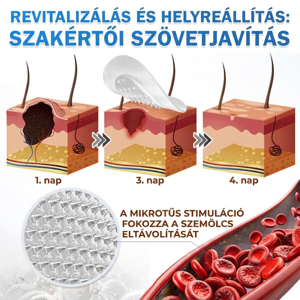 ✨HISKIN® 2 az 1-ben mikrotűs és hidrokolloid tapasz🍀 | Kiemelkedő anyajegyek, pattanások, lapos szemölcsök és bőrcimpák eltávolítására | Segít csökkenteni a ráncokat, hegeket és foltokat | Láthatatlan tapasz arcra és testre