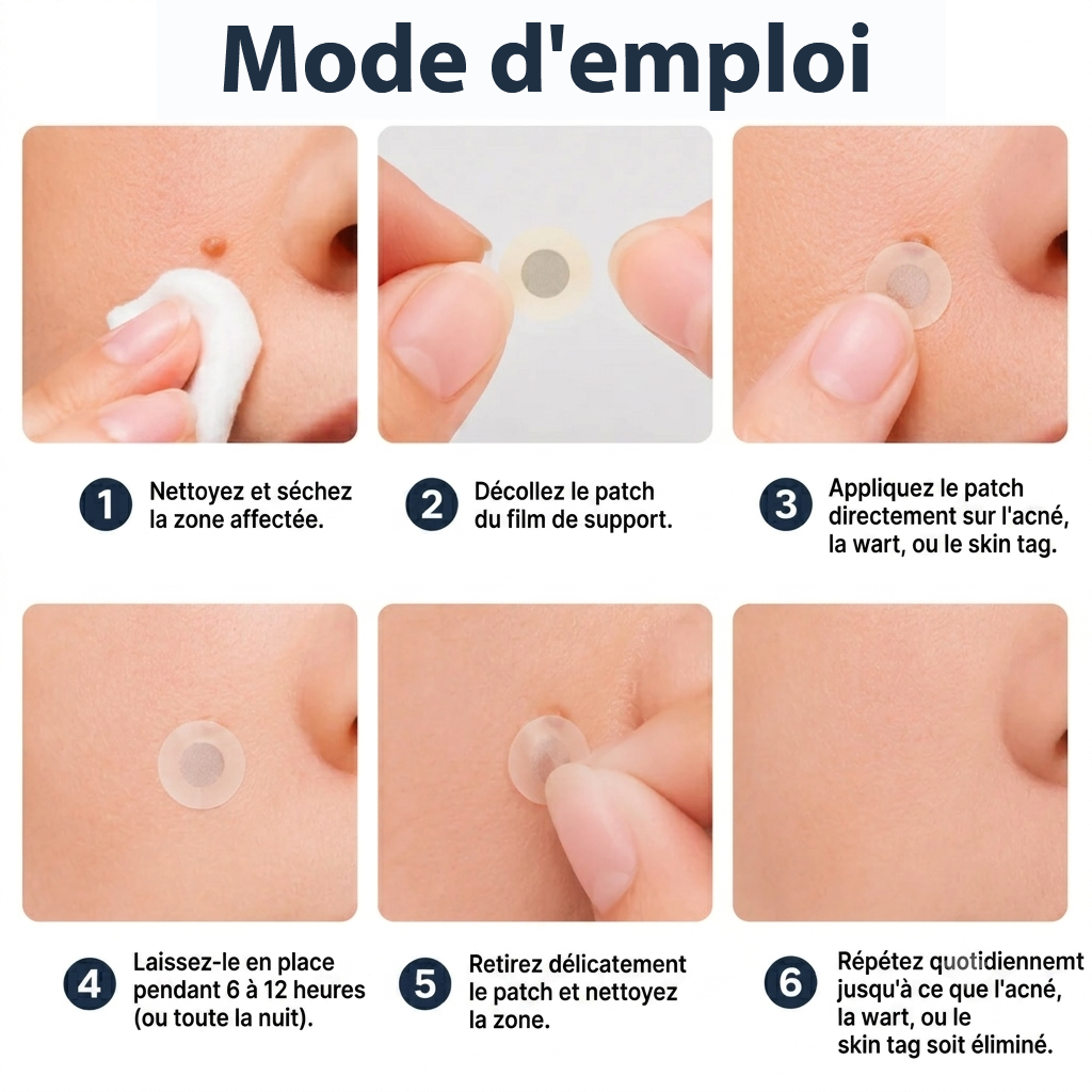 ✨HISKIN® 2 az 1-ben mikrotűs és hidrokolloid tapasz🍀 | Kiemelkedő anyajegyek, pattanások, lapos szemölcsök és bőrcimpák eltávolítására | Segít csökkenteni a ráncokat, hegeket és foltokat | Láthatatlan tapasz arcra és testre