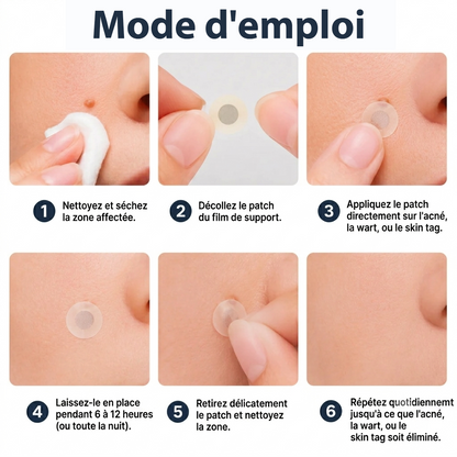 ✨HISKIN® 2 az 1-ben mikrotűs és hidrokolloid tapasz🍀 | Kiemelkedő anyajegyek, pattanások, lapos szemölcsök és bőrcimpák eltávolítására | Segít csökkenteni a ráncokat, hegeket és foltokat | Láthatatlan tapasz arcra és testre